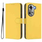 For OPPO Reno11 5G Global Skin Feel Solid Color Leather Phone Case with Lanyard(Lemon Yellow) - 2