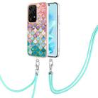 For Honor 200 Lite Global Electroplating Pattern IMD TPU Shockproof Case with Neck Lanyard(Colorful Scales) - 1