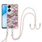 For OPPO A60 Electroplating Pattern IMD TPU Shockproof Case with Neck Lanyard(Pink Scales) - 2