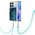 For Xiaomi Poco F6 Pro 5G Electroplating Marble Dual-side IMD Phone Case with Lanyard(Green 017) - 1