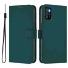 For Cubot P50 Skin Feel Solid Color Leather Phone Case with Lanyard(Dark Green) - 2