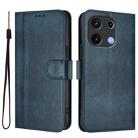 For UMIDIGI Note 100 Line Splicing Buckle Retro Leather Phone Case(Dark Blue) - 2