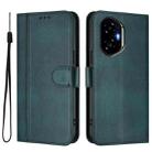 For Honor 300 Line Splicing Buckle Retro Leather Phone Case(Dark Green) - 2