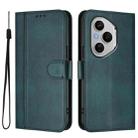 For Honor 400 Pro Global 160.8mm Line Splicing Buckle Retro Leather Phone Case(Dark Green) - 2