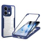 For OPPO Reno13 5G Global 360 Degrees Full Body Phone Case(Blue) - 1