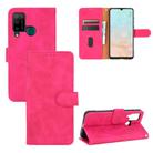 For DOOGEE N20 Pro Solid Color Skin Feel Magnetic Buckle Horizontal Flip Calf Texture PU Leather Case with Holder & Card Slots & Wallet(Rose Red) - 1