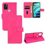 For UMIDIGI A9 Pro Solid Color Skin Feel Magnetic Buckle Horizontal Flip Calf Texture PU Leather Case with Holder & Card Slots & Wallet(Rose Red)