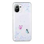 For Xiaomi Mi 11 Lite Coloured Drawing Pattern Transparent TPU Protective Case(Flower Butterfly)