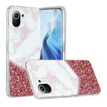 For Xiaomi Mi 11 Lite Marble Pattern Soft TPU Protective Case(Colorblock)