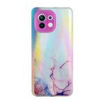 For Xiaomi Mi 11 Laser Marble Pattern Clear TPU Shockproof Protective Case(Pink)