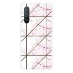 For OnePlus Nord CE 5G Abstract Marble Pattern TPU Protective Case(Pink)