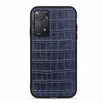 For Xiaomi Redmi Note 11 Pro Global Crocodile Texture Leather Shockproof Phone Case(Blue)