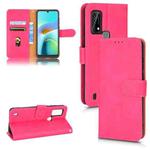 For Blackview A50 Skin Feel Magnetic Flip Leather Phone Case(Rose Red)