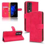 For Honor 80 GT Skin Feel Magnetic Flip Leather Phone Case(Rose Red)