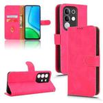 For vivo Y29 4G Global Skin Feel Magnetic Flip Leather Phone Case(Rose Red)