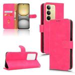 For Realme C75 4G Skin Feel Magnetic Flip Leather Phone Case(Rose Red)