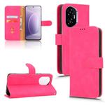 For Honor 300 Skin Feel Magnetic Flip Leather Phone Case(Rose Red)