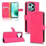 For Honor 400 Lite Skin Feel Magnetic Flip Leather Phone Case(Rose Red)