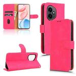 For Honor 400 Skin Feel Magnetic Flip Leather Phone Case(Rose Red)