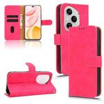 For Honor 400 Pro Global 160.8mm Skin Feel Magnetic Flip Leather Phone Case(Rose Red)