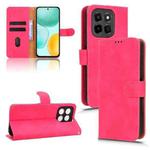 For Honor X6c 4G Skin Feel Magnetic Flip Leather Phone Case(Rose Red)
