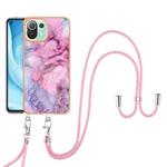 For Xiaomi 11 Lite Electroplating Marble Dual-side IMD Phone Case with Lanyard(Pink 013)