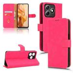 For Ulefone Note 18 Ultra Skin Feel Magnetic Flip Leather Phone Case(Rose Red)