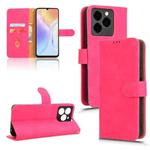 For Ulefone Note 20 Pro Skin Feel Magnetic Flip Leather Phone Case(Rose Red)