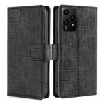 For Honor 200 Lite 5G Global Skin Feel Crocodile Magnetic Clasp Leather Phone Case(Black)