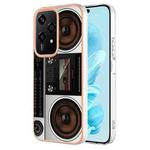 For Honor 200 Lite Global Electroplating Marble Dual-side IMD Phone Case(Retro Radio)