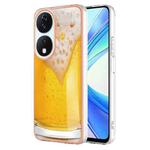 For Honor X7b 4G / 5G Electroplating Marble Dual-side IMD Phone Case(Draft Beer)