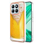 For Honor X8b Electroplating Marble Dual-side IMD Phone Case(Draft Beer)