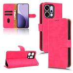 For OPPO Reno14 Pro Global Skin Feel Magnetic Flip Leather Phone Case(Rose Red)