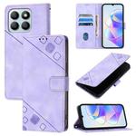 For Honor X8b Skin-feel Embossed Leather Phone Case(Light Purple)