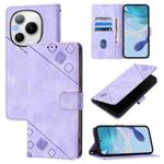 For Honor Power 5G Skin-feel Embossed Leather Phone Case(Light Purple)