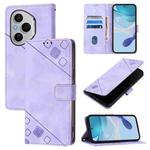 For Honor 400 Pro 5G Global Skin-feel Embossed Leather Phone Case(Light Purple)