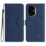 For Honor 300 Heart Pattern Skin Feel Leather Phone Case(Royal Blue)