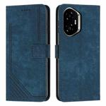 For Honor 400 Skin Feel Stripe Pattern Leather Phone Case with Lanyard(Blue)