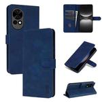 For Huawei nova 12 AZNS Skin Feel Calf Texture Flip Leather Phone Case(Blue)