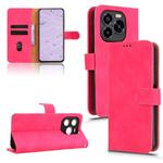 For Oukitel C65 / C65 Pro Skin Feel Magnetic Flip Leather Phone Case(Rose Red)
