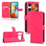 For ZTE nubia Music 2 Skin Feel Magnetic Flip Leather Phone Case(Rose Red)