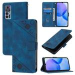 For TCL 30 5G Skin Feel Embossed Leather Phone Case(Blue)