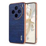 For vivo X200s AZNS Electroplated Frame Crocodile Texture Full Coverage Phone Case(Blue)