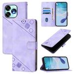 For Umidigi A15 / A15C / A15T Skin-feel Embossed Leather Phone Case(Light Purple)