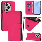 For Honor 400 Pro Global 160.8mm Skin Feel Solid Color Leather Phone Case with Lanyard(Rose Red)