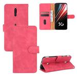 For ZTE Nubia Red Magic 5G Solid Color Skin Feel Magnetic Buckle Horizontal Flip Calf Texture PU Leather Case with Holder & Card Slots & Wallet(Rose Red)