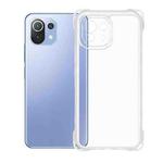 For Xiaomi 11 Lite Kalebol 1.5mm Thickened Four-Corner Shockproof TPU Phone Case