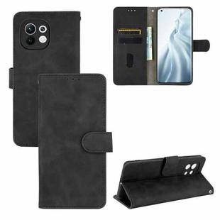 For Xiaomi Mi 11 Solid Color Skin Feel Magnetic Buckle Horizontal Flip Calf Texture PU Leather Case with Holder & Card Slots & Wallet(Black)