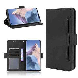 For Xiaomi Mi 11 Ultra Skin Feel Calf Pattern Horizontal Flip Leather Case with Holder & Card Slots & Photo Frame(Black)