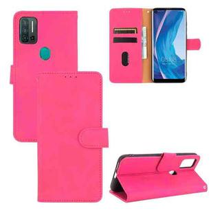 For Ulefone Note 11P Solid Color Skin Feel Magnetic Buckle Horizontal Flip Calf Texture PU Leather Case with Holder & Card Slots & Wallet(Rose Red)